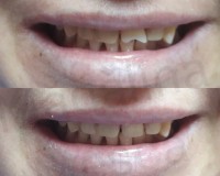 Dr. Madalina Mesca - Stomatologie Moderna Adulti si Copii Dr. Madalina Mesca - Stomatologie Moderna Adulti si Copii