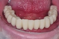 DENTAL PRIVILEGE  DENTAL PRIVILEGE