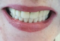 DENTAL PRIVILEGE  DENTAL PRIVILEGE