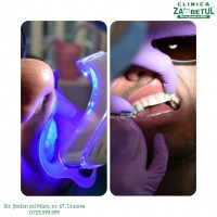 Albire dentara Albire dentara