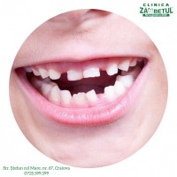 Tratament copii  Tratament copii